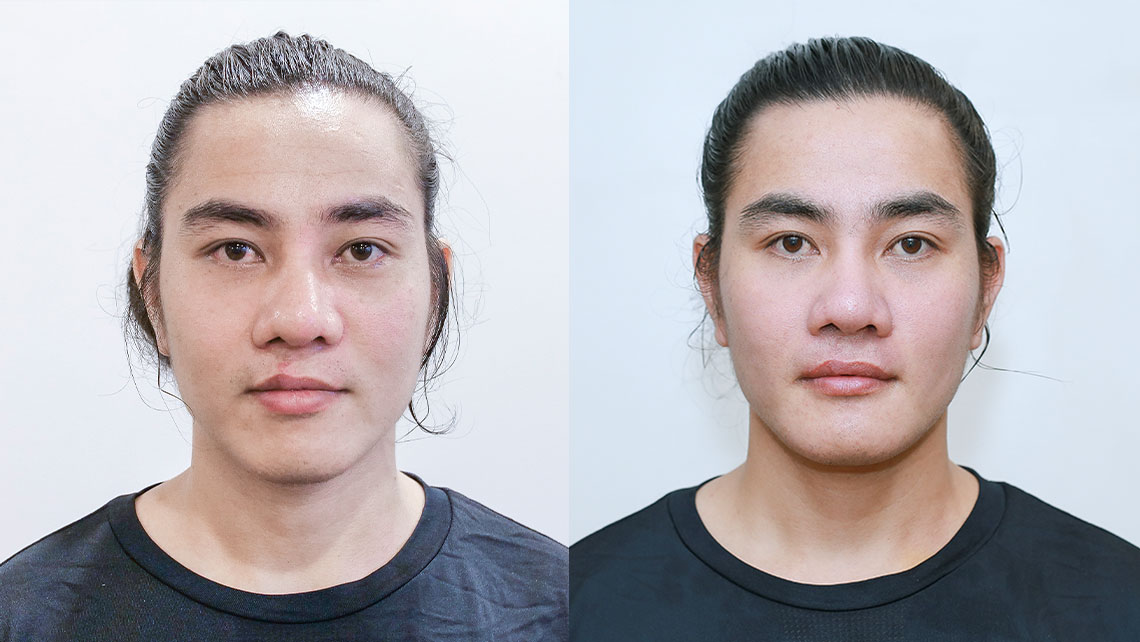 100 ngày thay đổi của tự