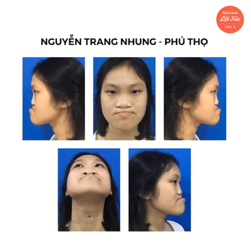 nguyễn trang nhung hành trình lột xác 