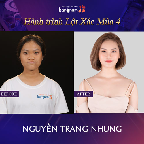 nguyễn trang nhung 
