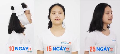 trang nhung sau 10 ngày phẫu thuật