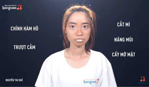 Nguyễn Thị Huê thực hiện những phẫu thuật gì?
