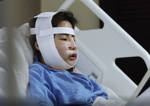 Nguyễn Thị Huê hậu phẫu