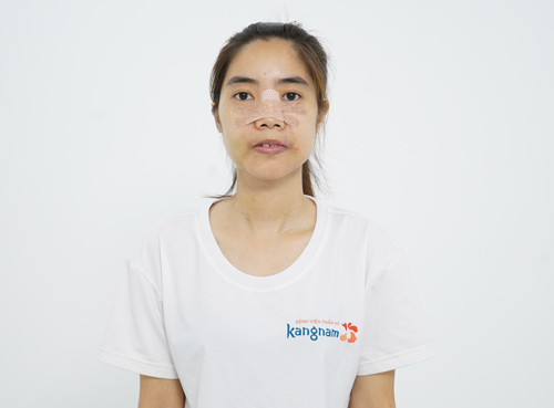 Nguyễn Thị Huê lột xác như thế nào?