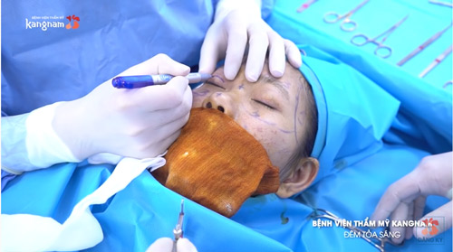 hành trình lột xác