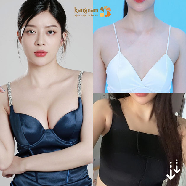 Dịch vụ nâng cấp vòng 1