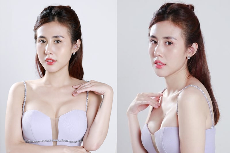 Beauty Up - Nâng tầm nhan sắc