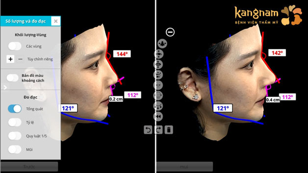 Ứng dụng công nghệ xem trước kết quả AI-FACE DESIGN