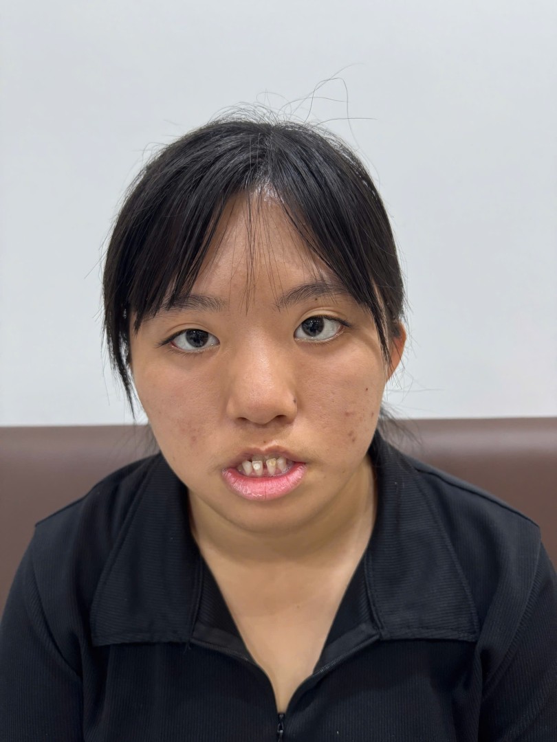 Ảnh lớn