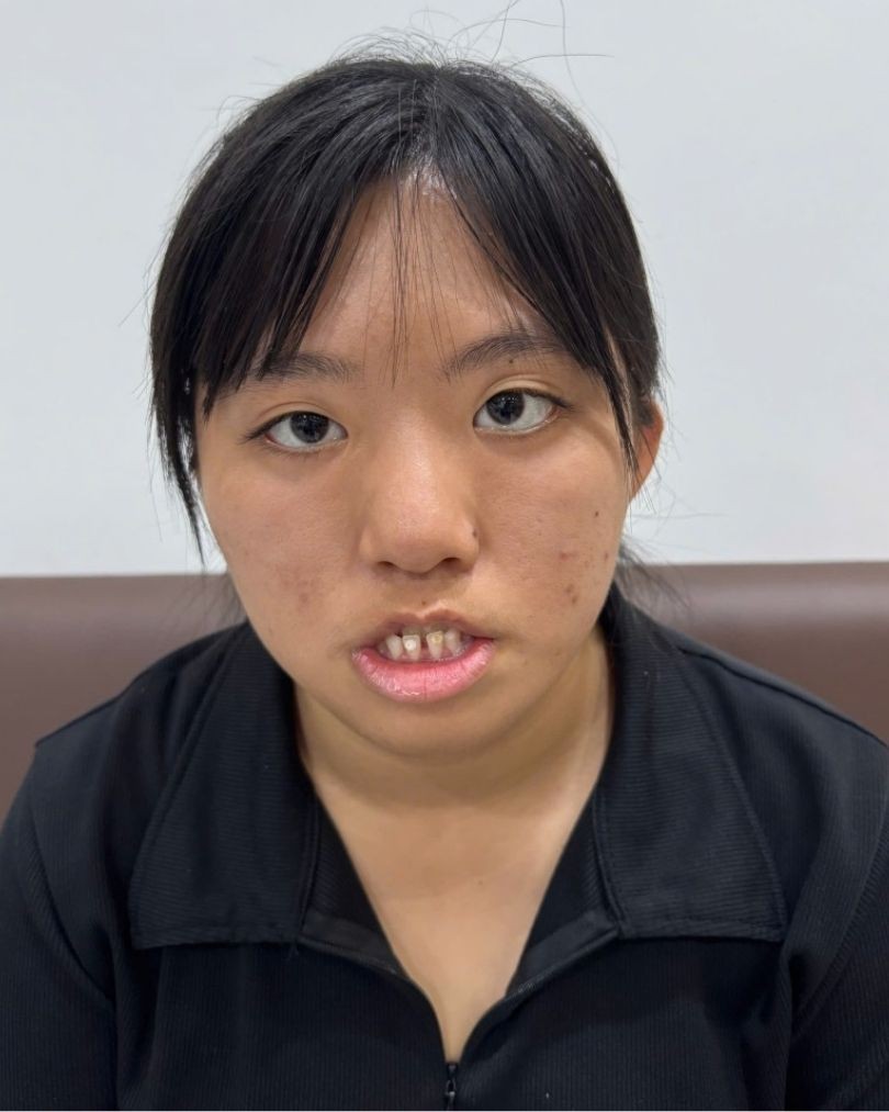 Ảnh lớn
