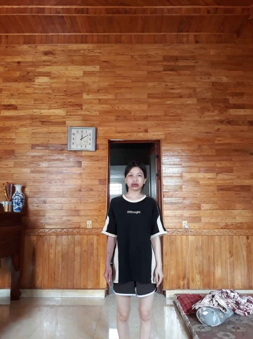 Toàn thân