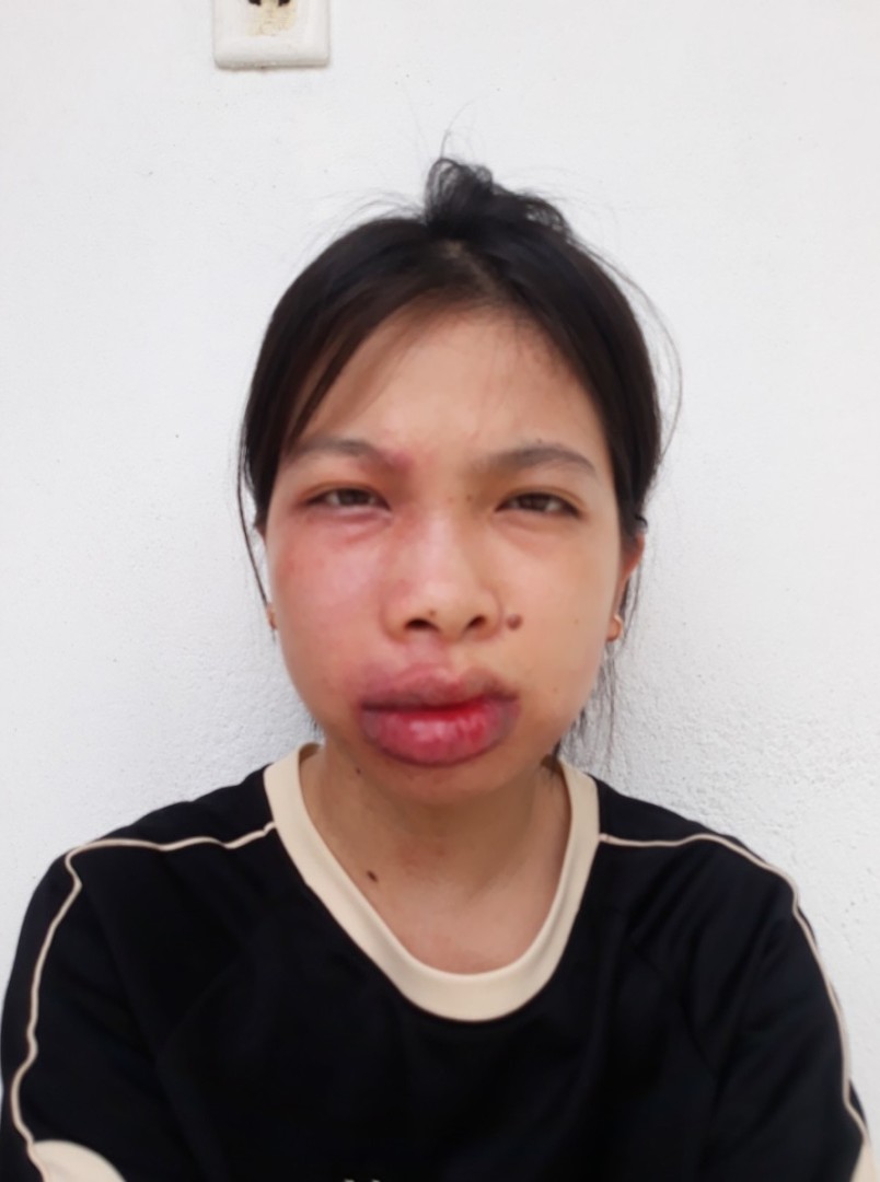 Ảnh lớn
