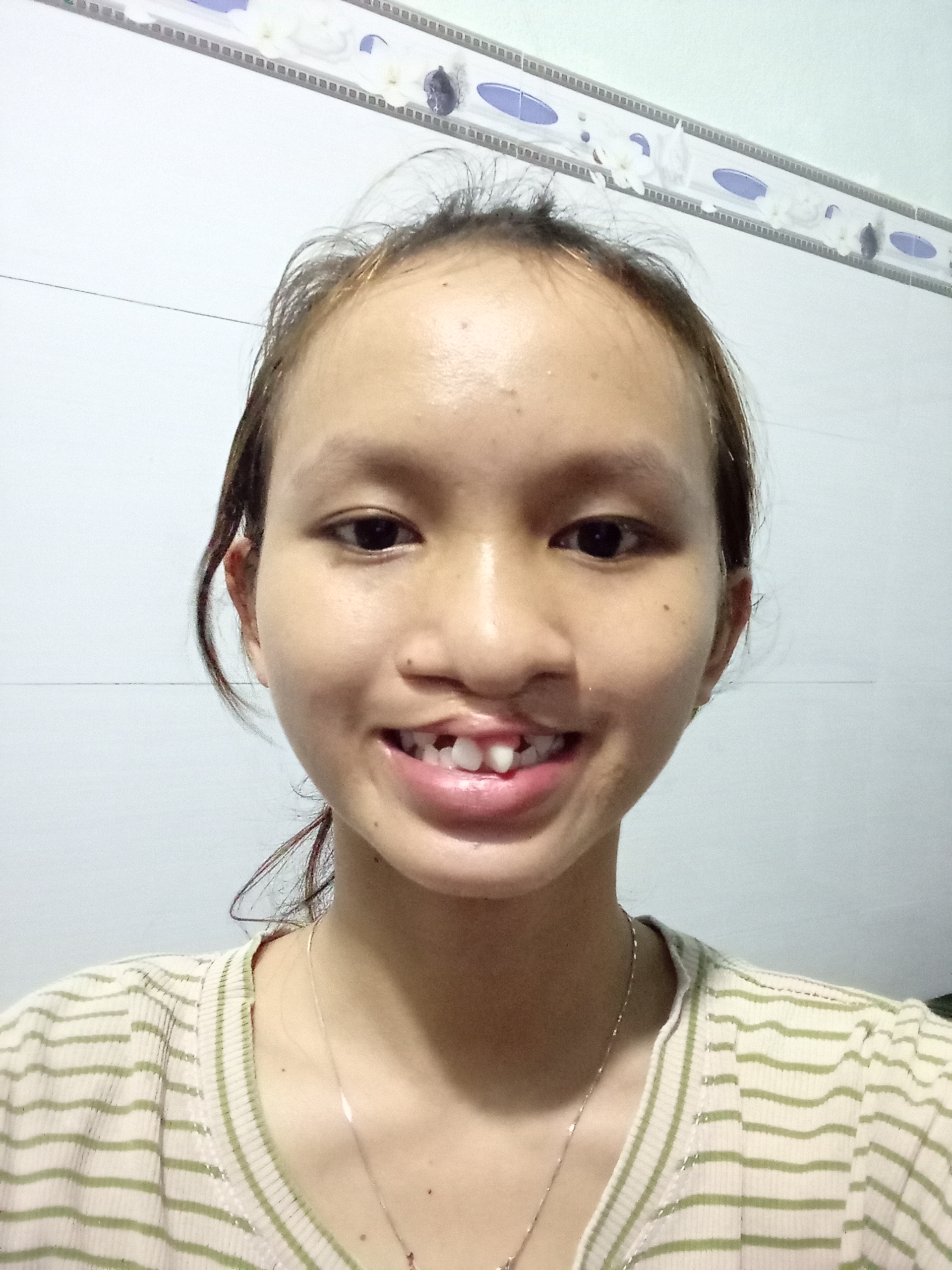 Ảnh lớn