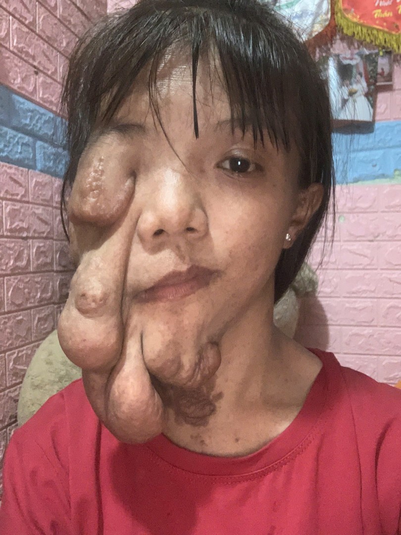 Ảnh lớn