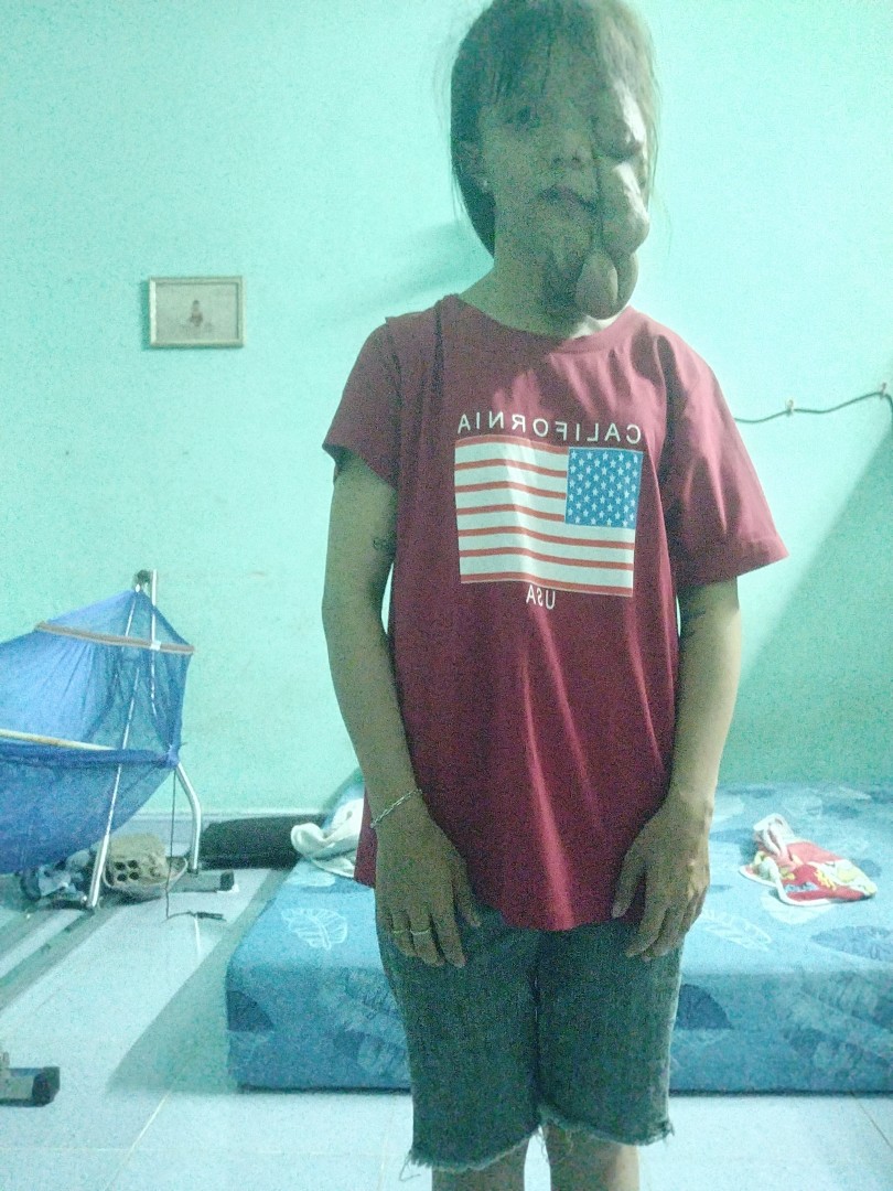 Toàn thân