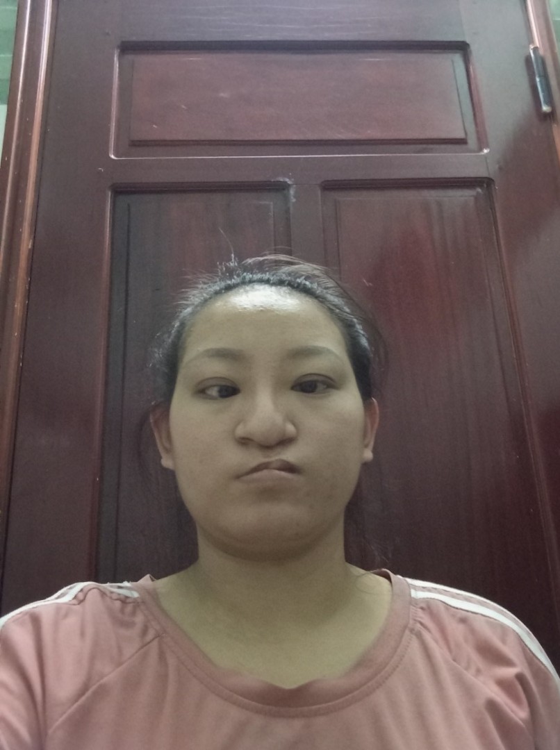 Toàn thân