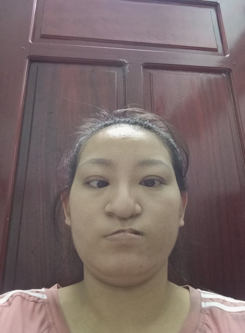 Ảnh lớn