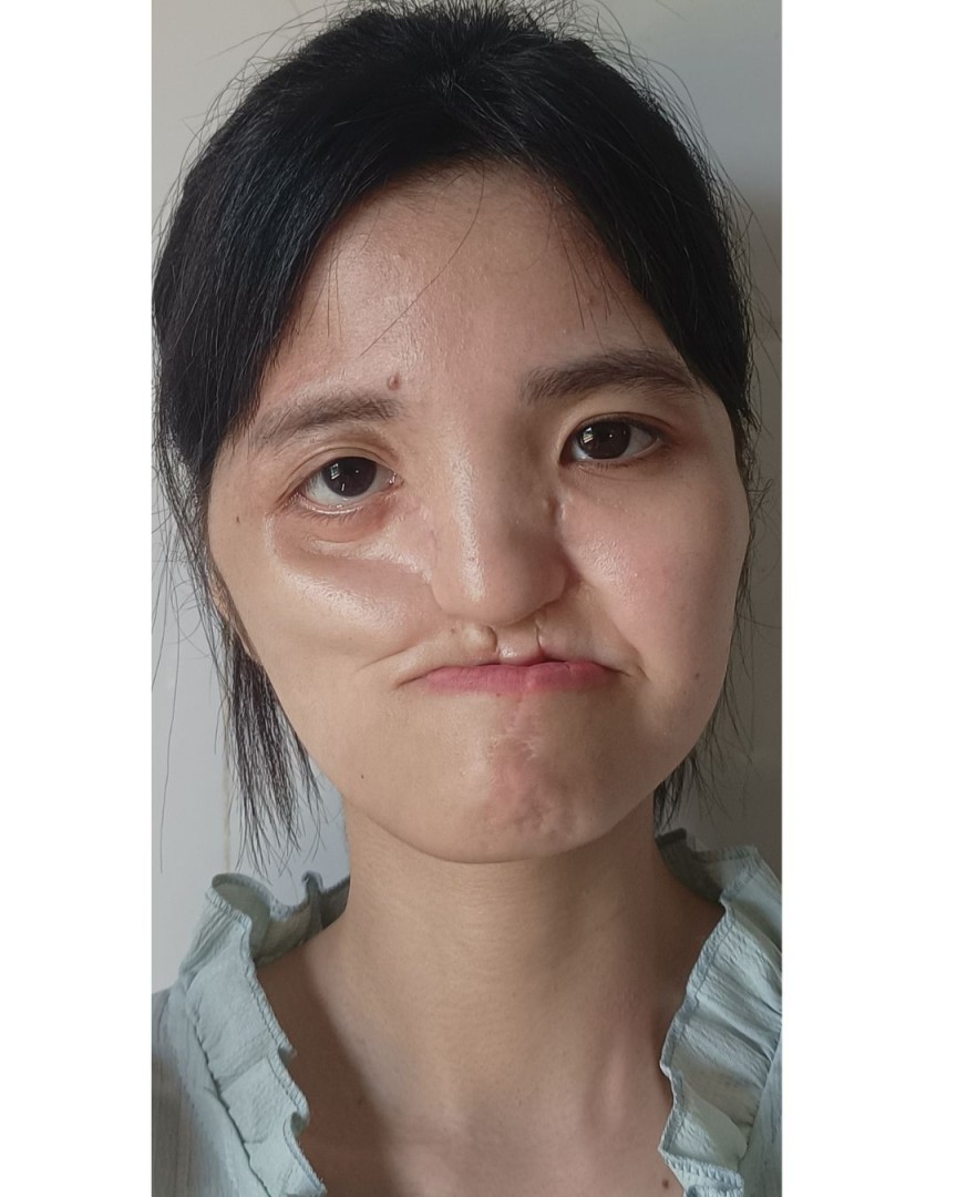 Ảnh lớn
