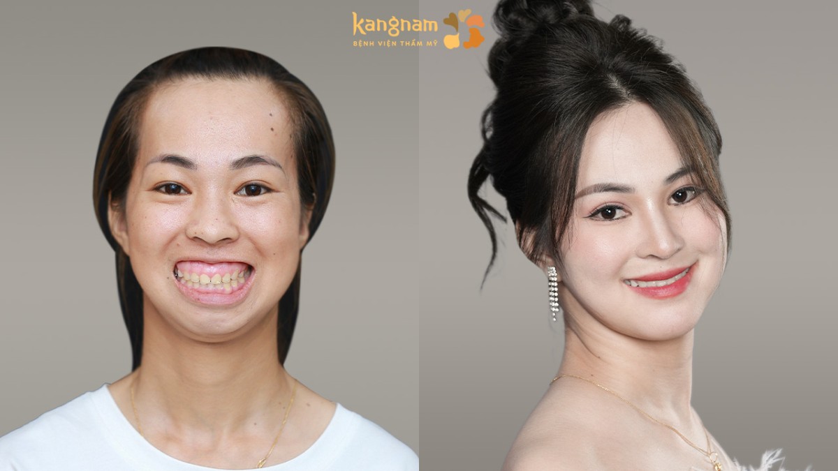 Thí sinh tỏa sáng sau chương trình nhờ ngoại hình ấn tượng