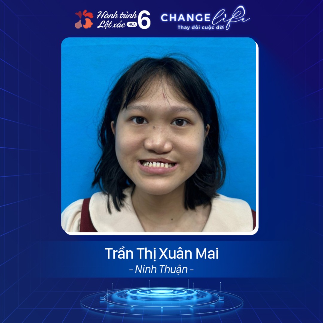Chuẩn bị ảnh chụp chân dung rõ nét