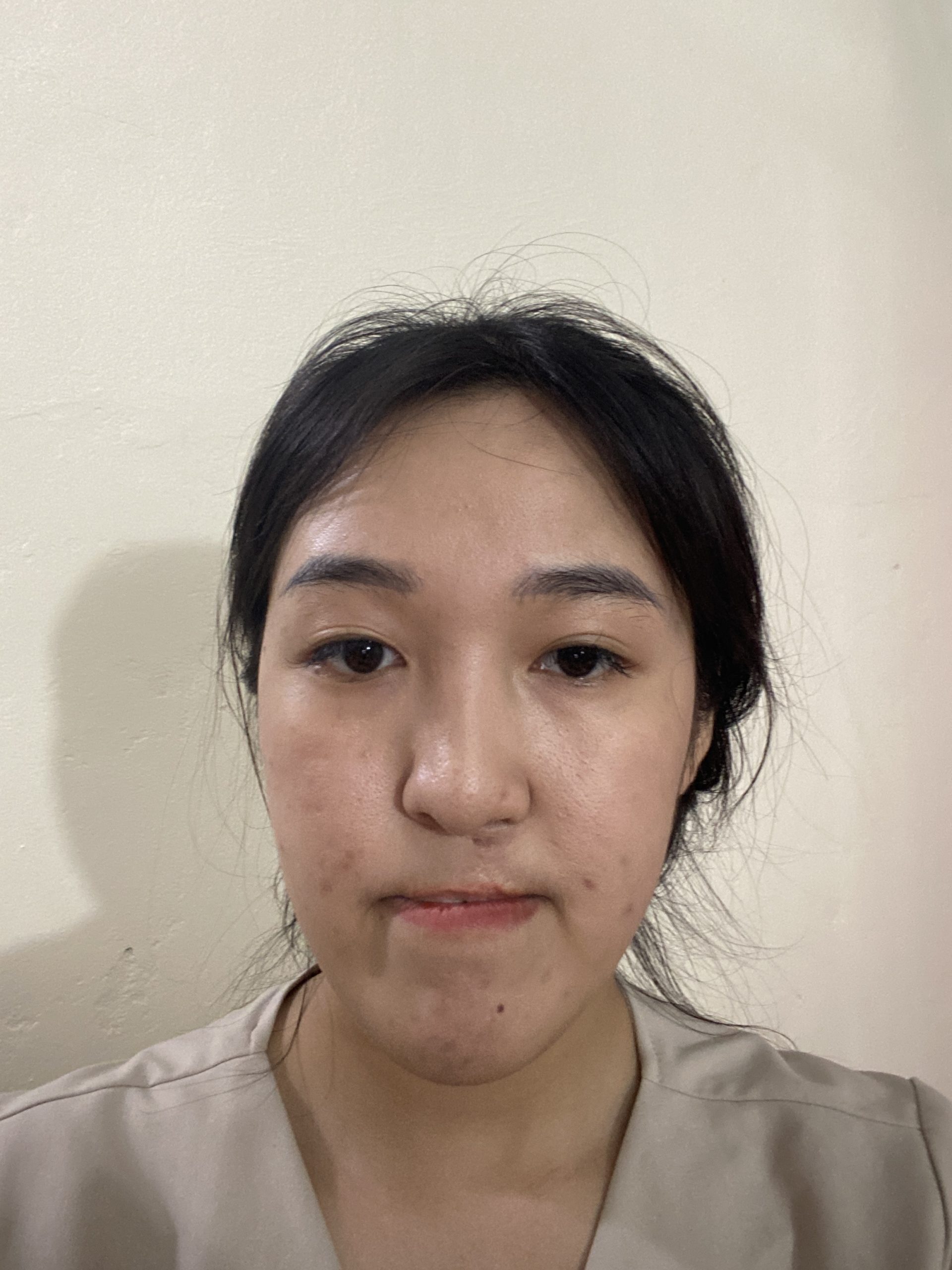 Ảnh lớn