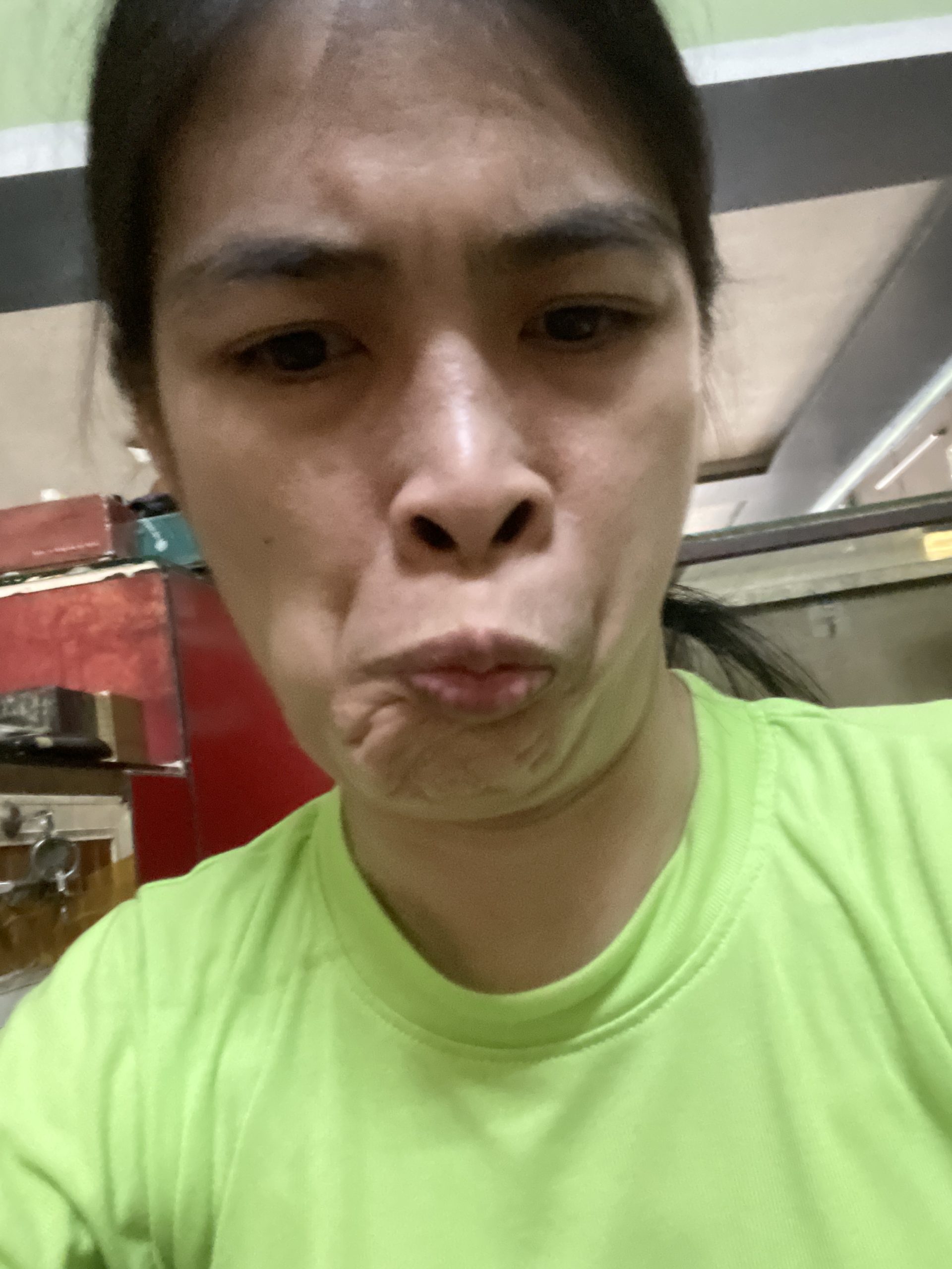 Ảnh lớn