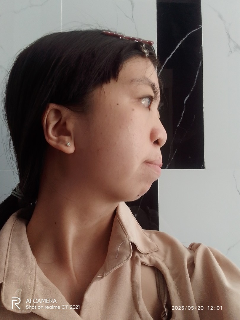 Nghiêng trái