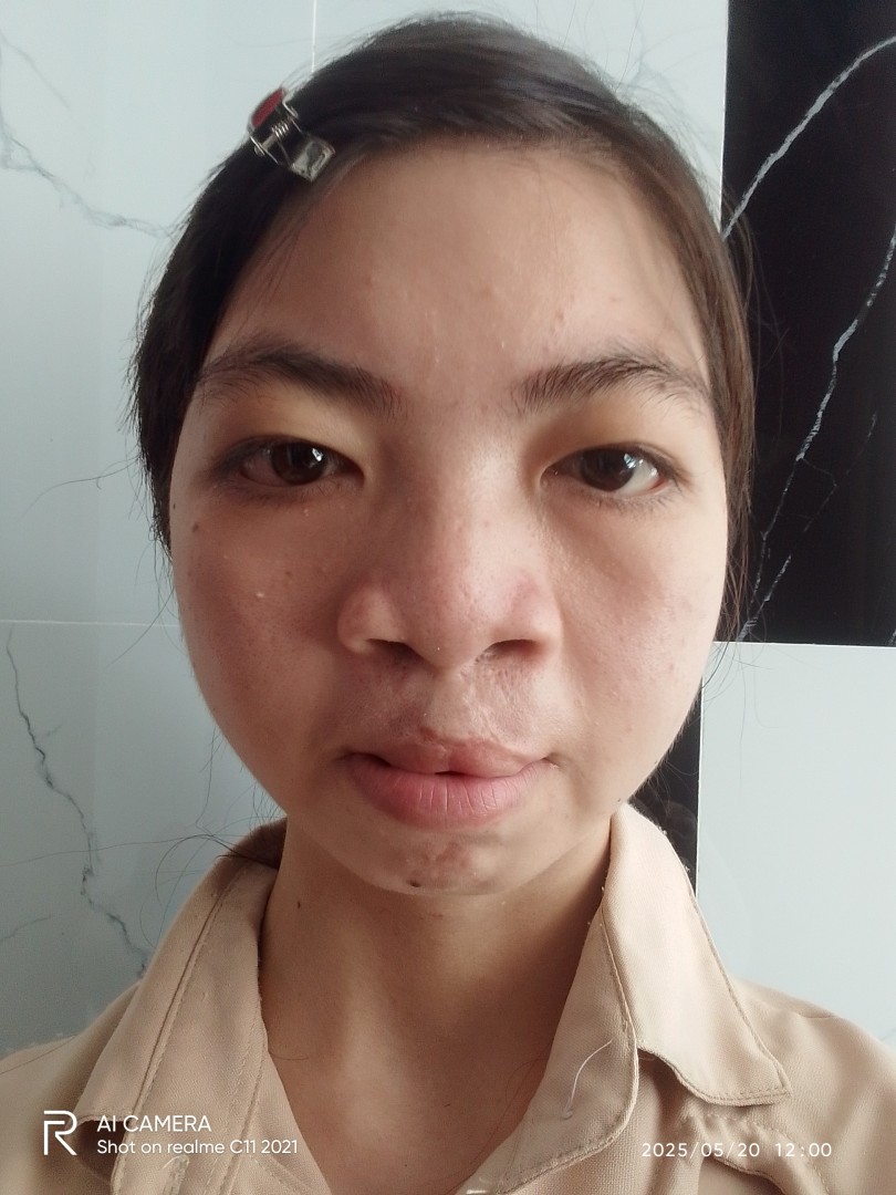 Ảnh lớn