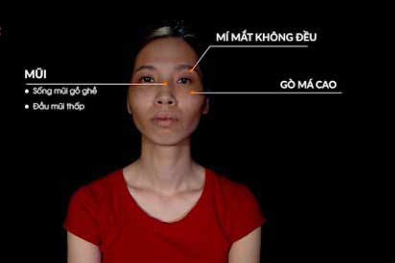 Phan Thị May trước phẫu thuật