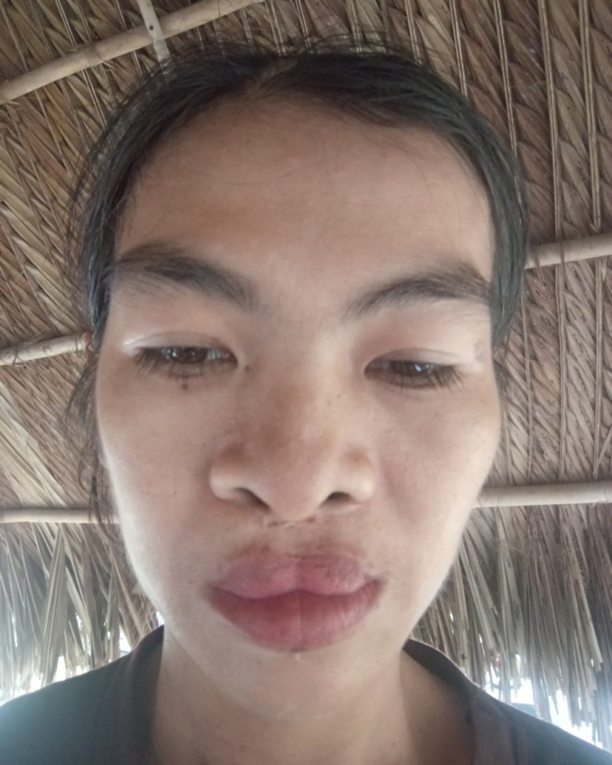 Ảnh lớn