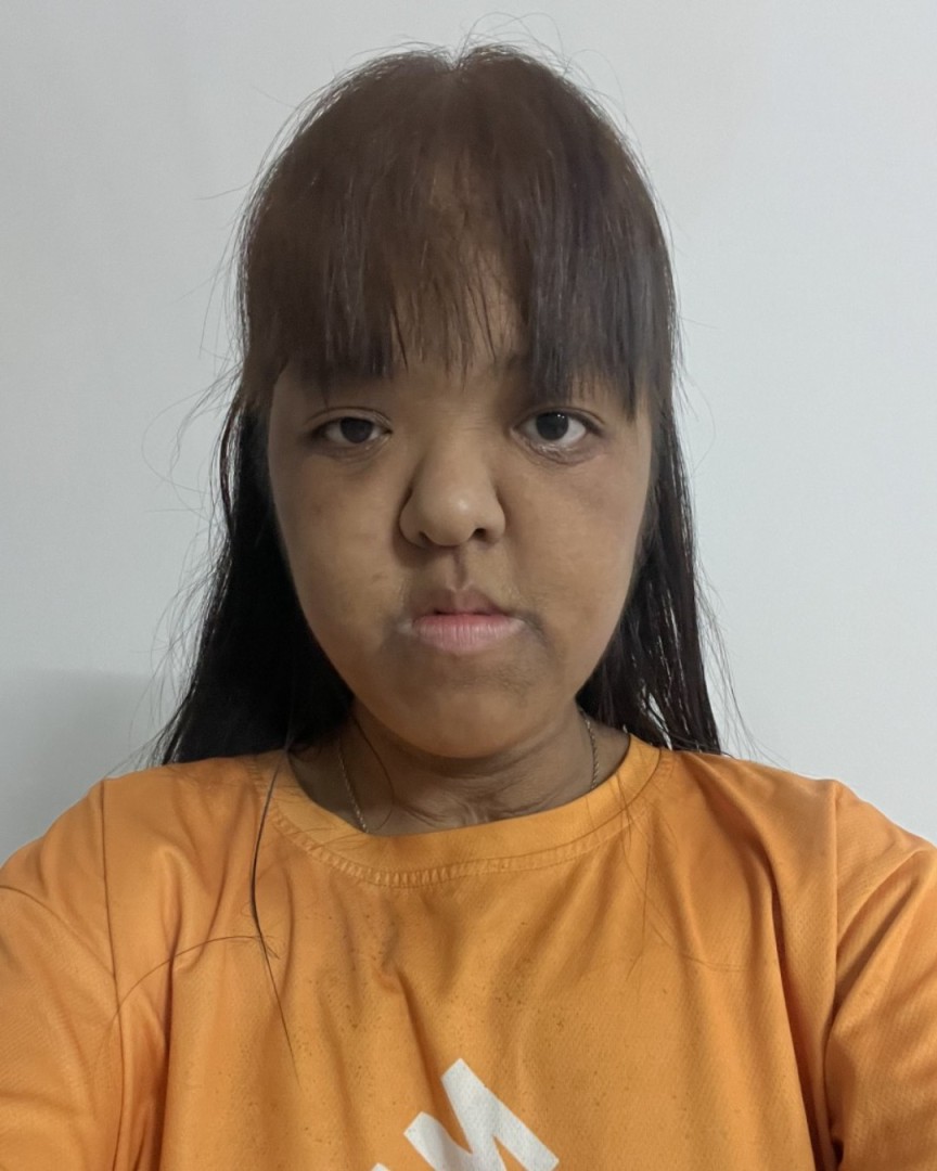 Ảnh lớn