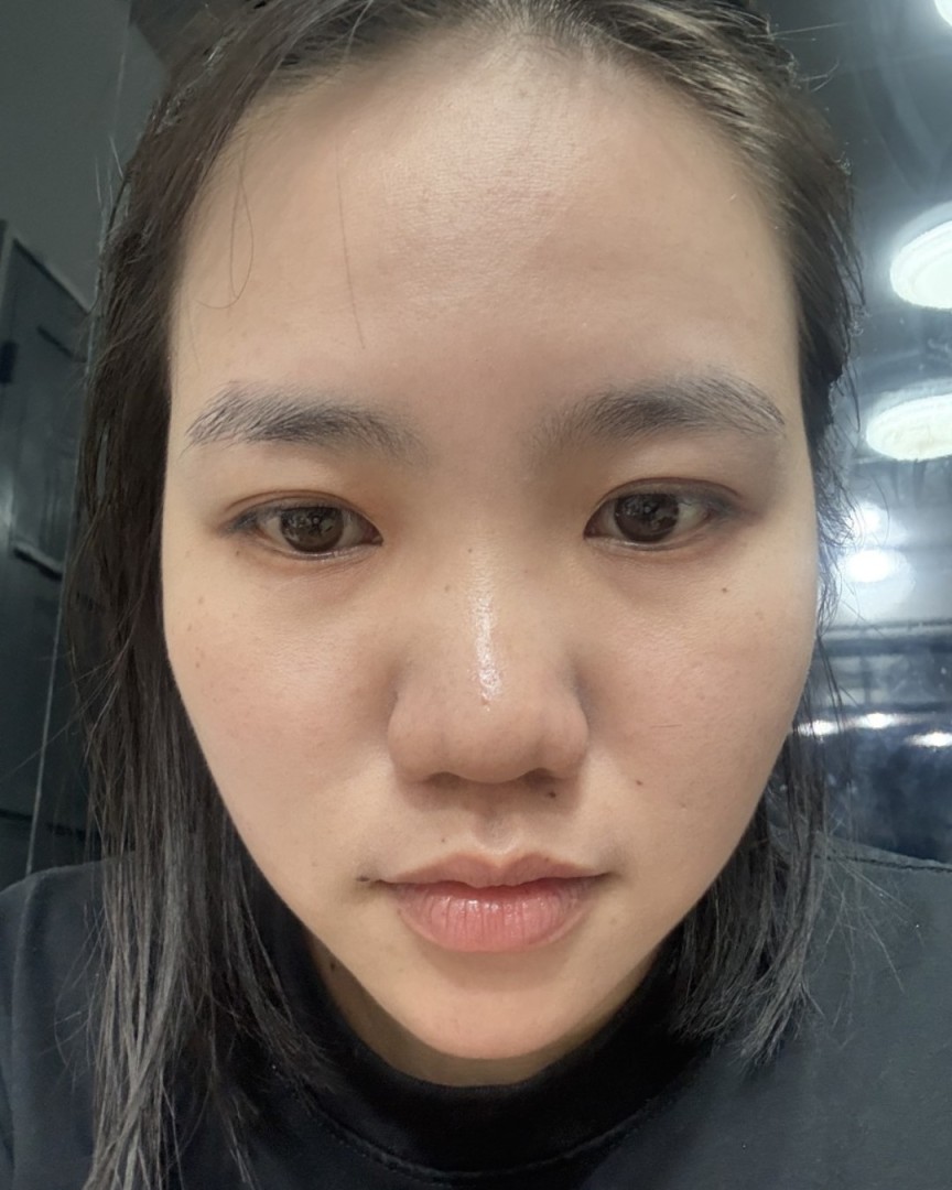 Ảnh lớn