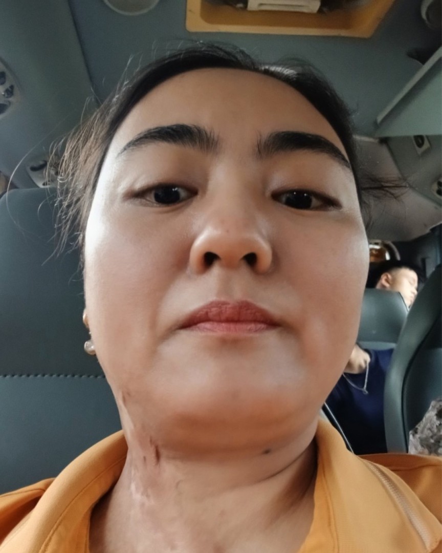 Ảnh lớn