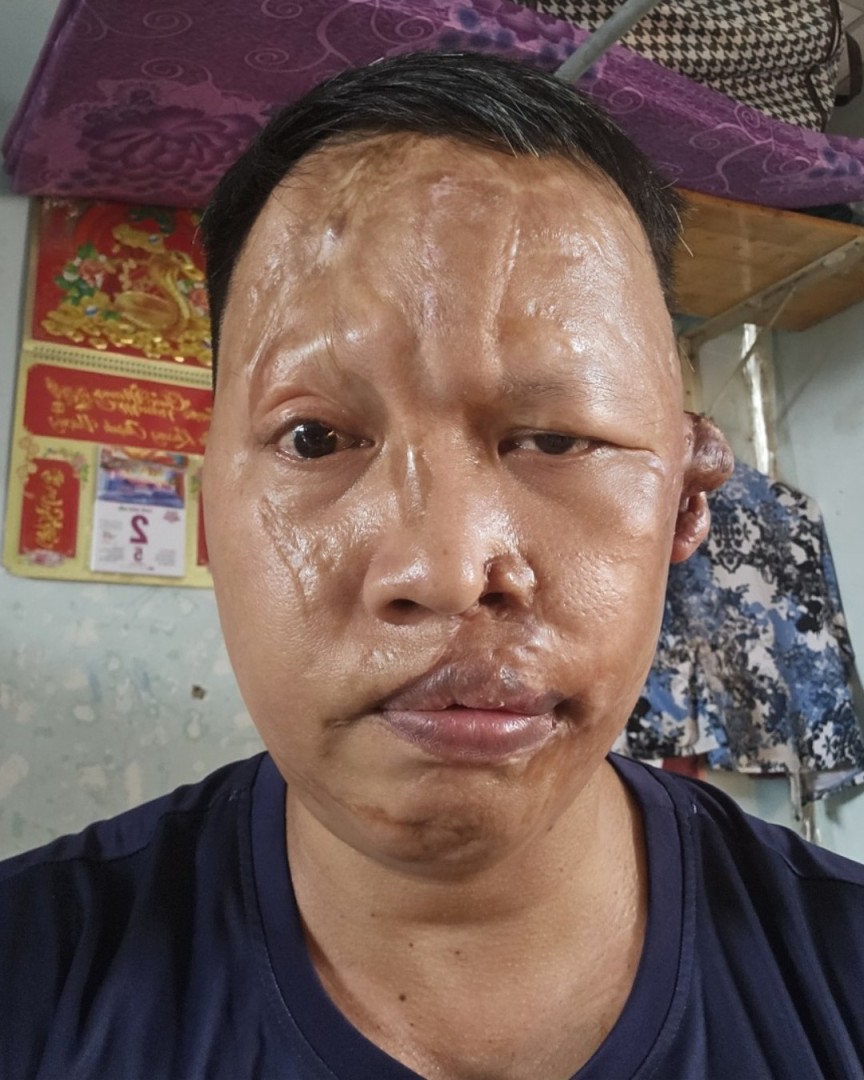 Ảnh lớn