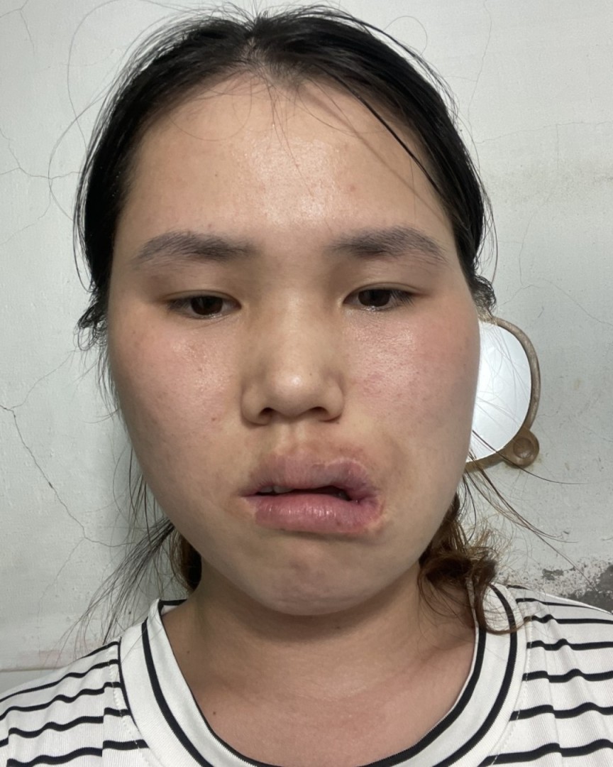 Ảnh lớn