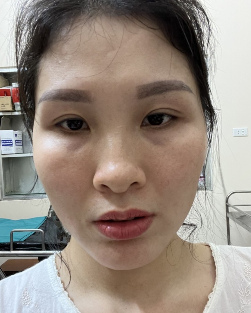 Ảnh lớn
