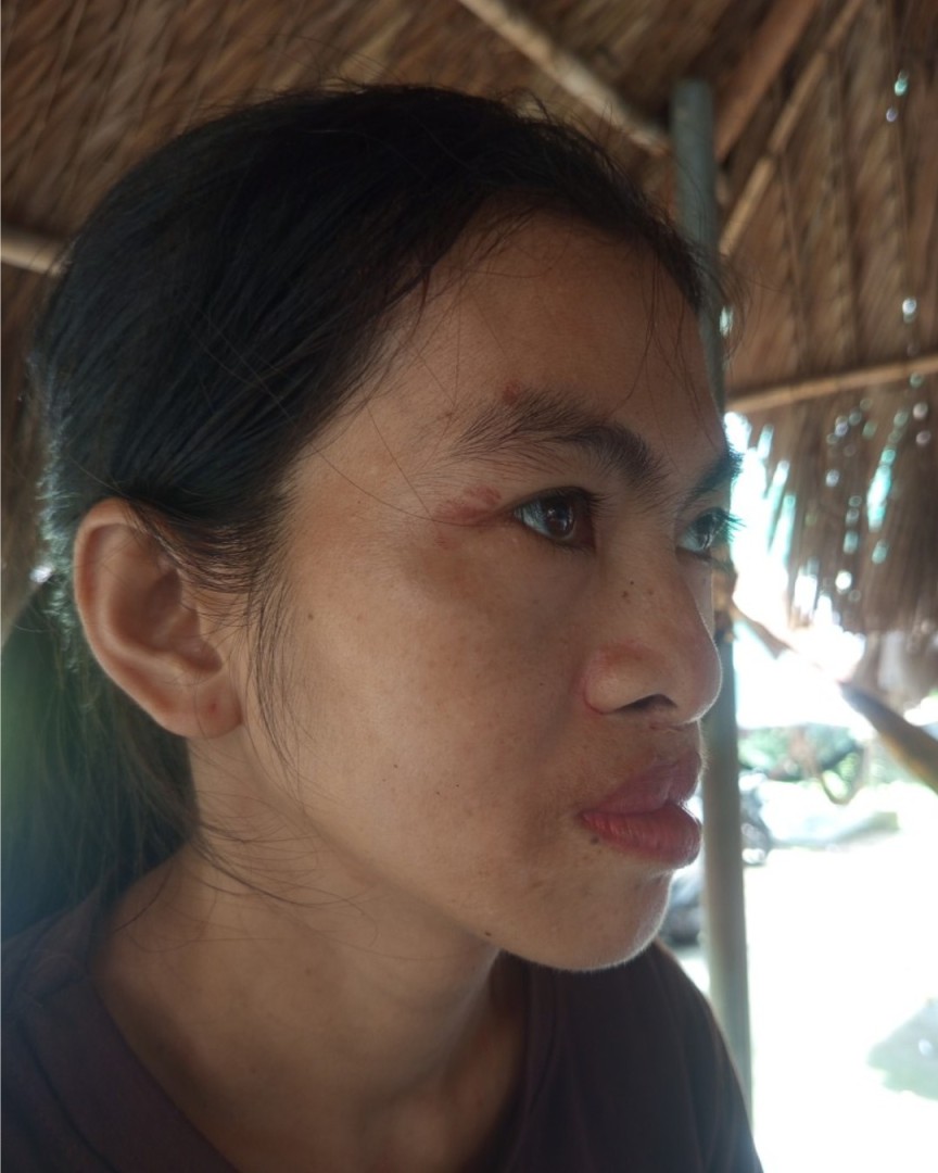 Nghiêng trái