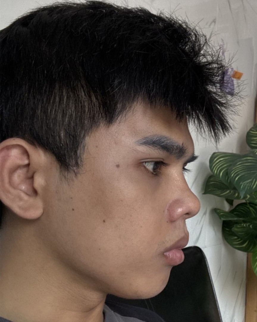 Nghiêng trái
