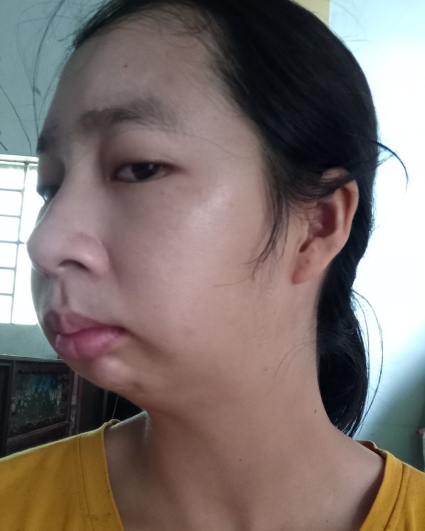 Nghiêng trái