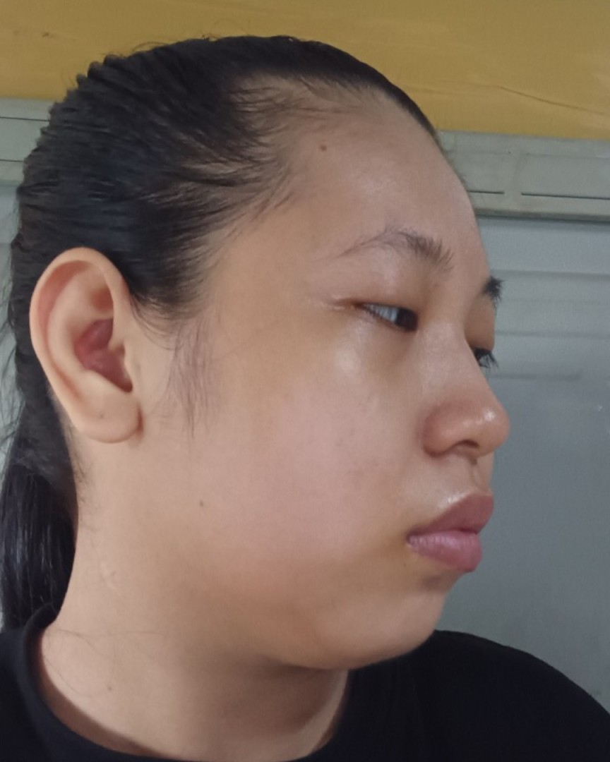 Nghiêng trái