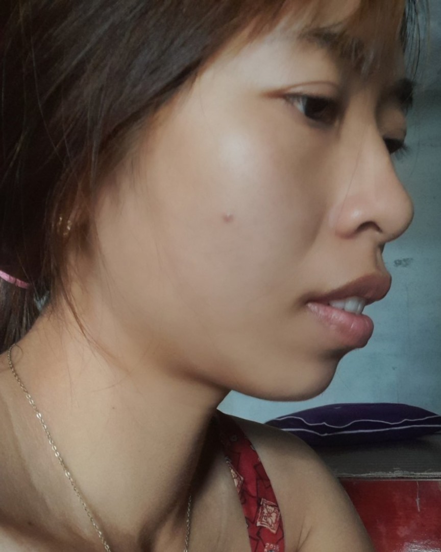 Nghiêng trái