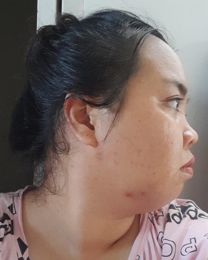 Nghiêng trái