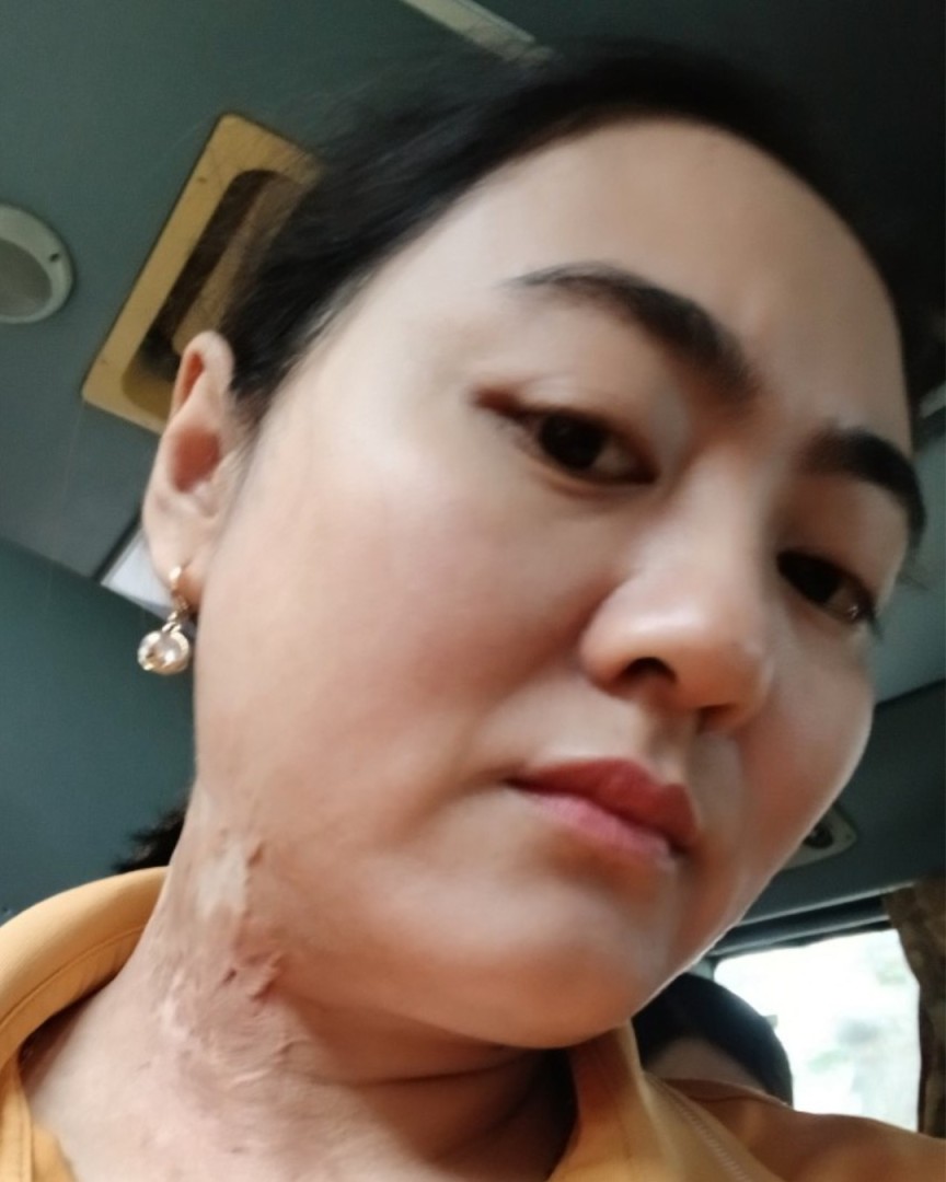 Nghiêng trái