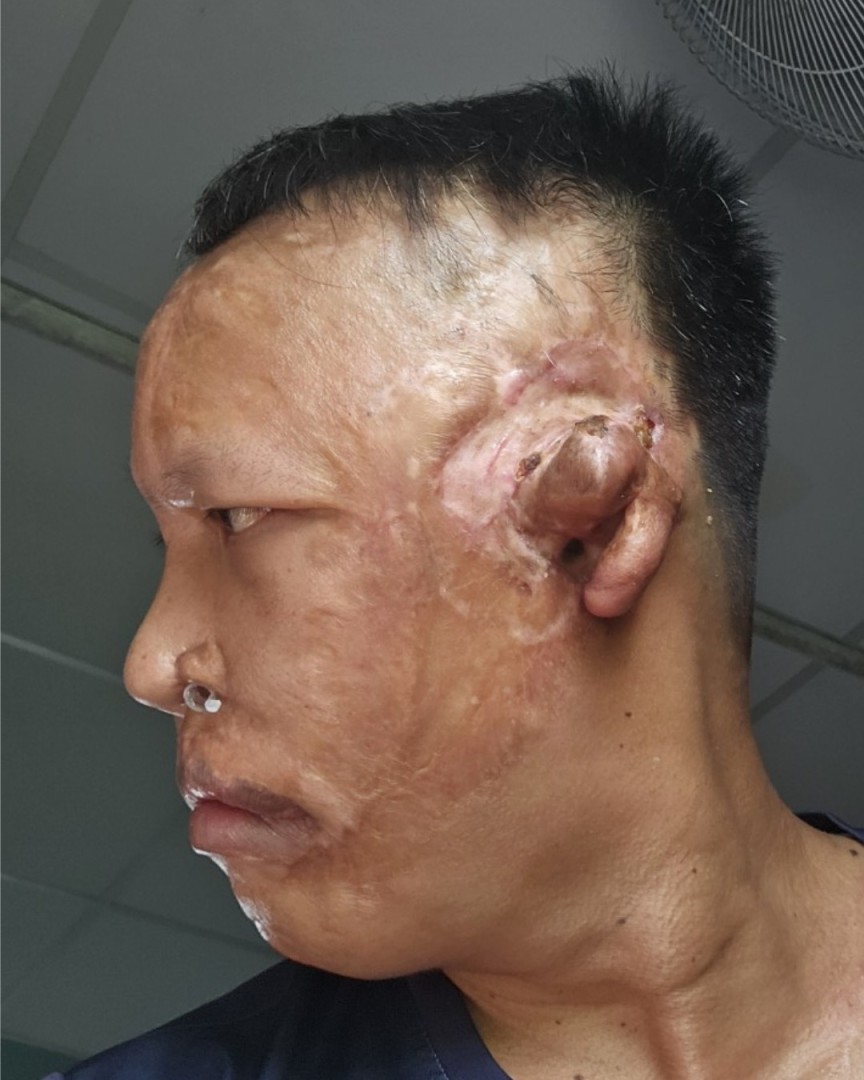 Nghiêng trái