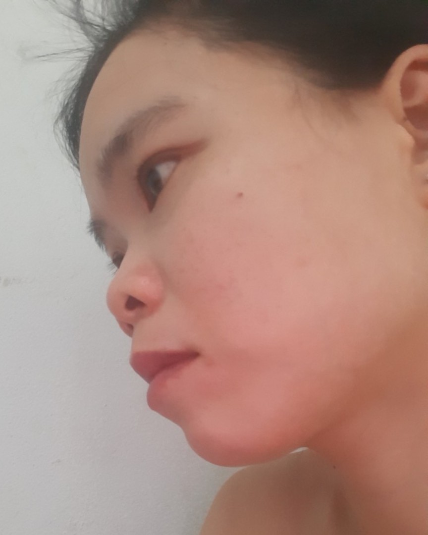 Nghiêng trái