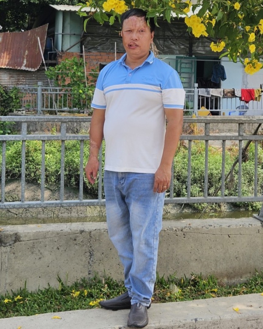 Toàn thân