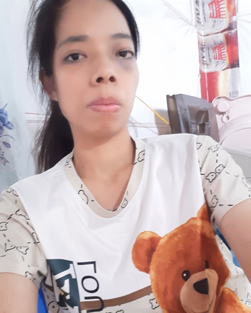 Toàn thân