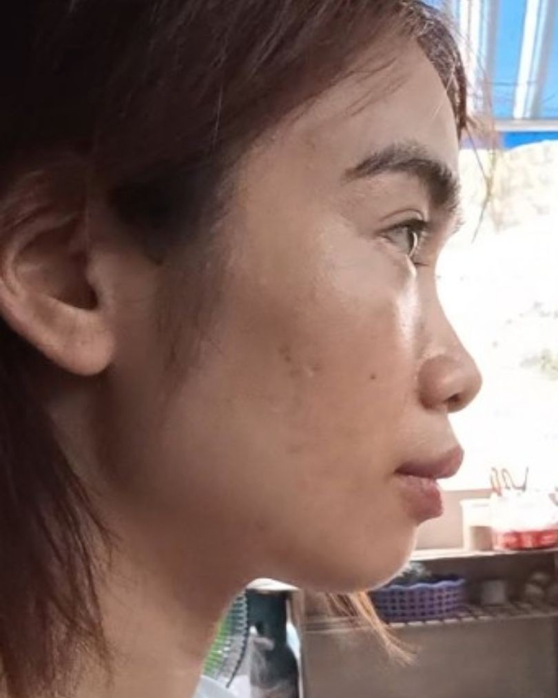 Nghiêng trái