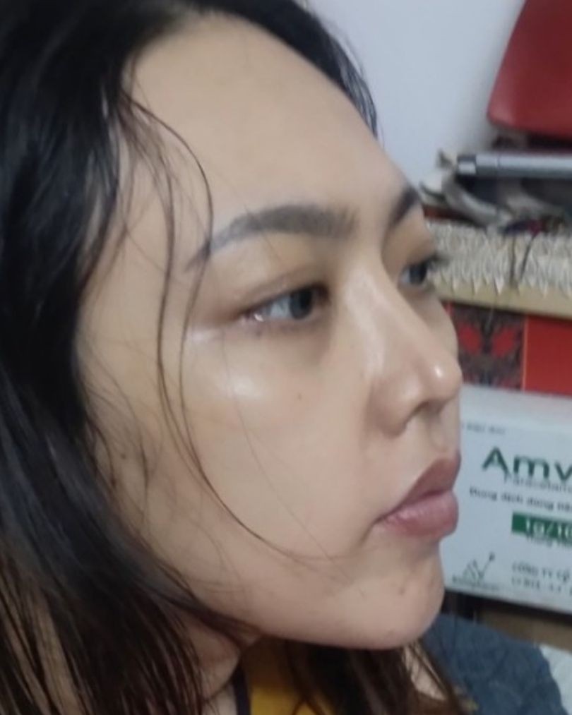 Nghiêng trái