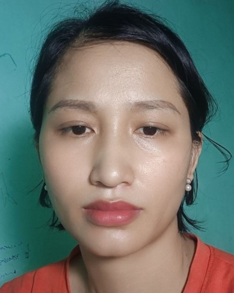 Ảnh lớn