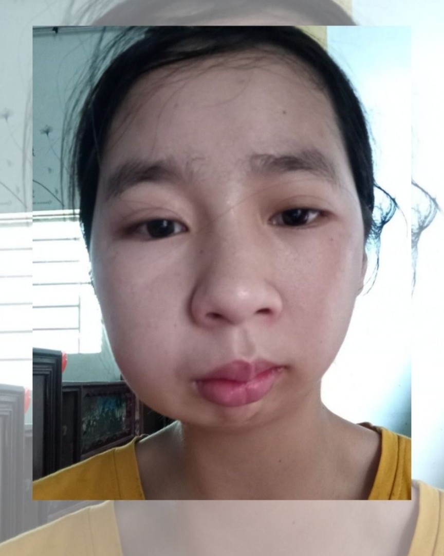 Ảnh lớn